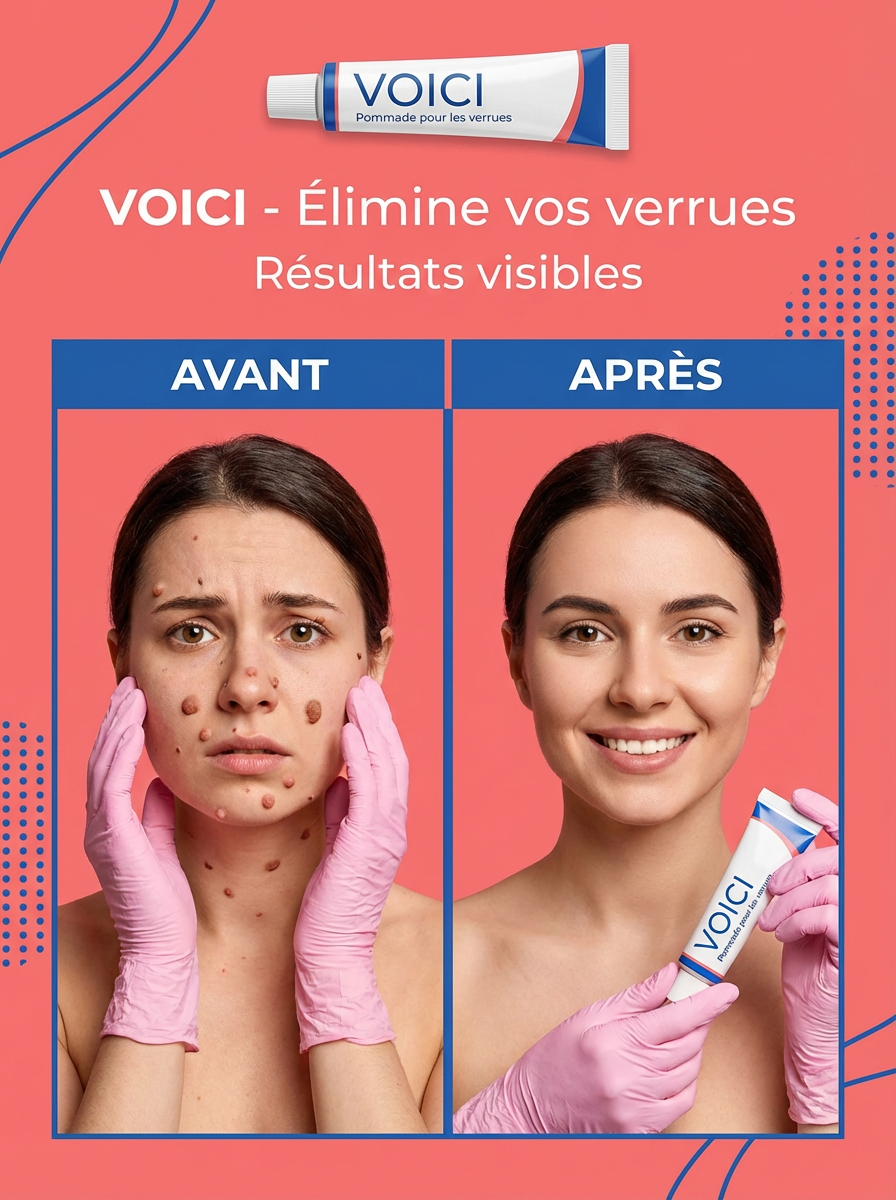 Crème élimination verrues